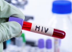 За прошлый год в Липецкой области выявлено 260 пациентов с ВИЧ